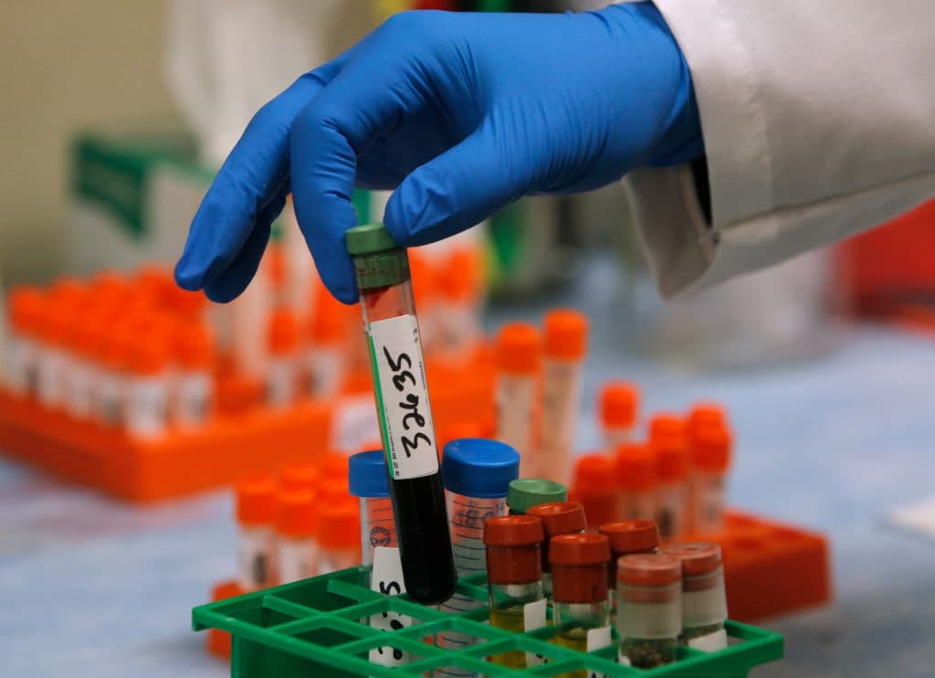 Should You Take a Blood Test to Detect Cancer?