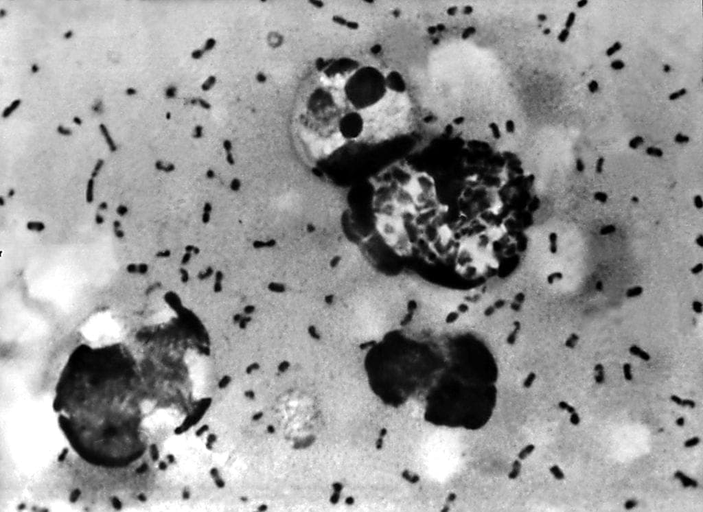 Russian Plague Lab Death Puts US on Alert