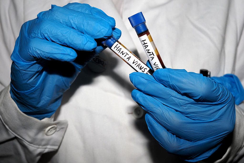 High on Health: What’s Going On With Hantavirus?