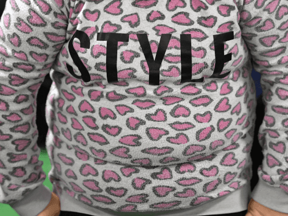 Obesity Crisis Far Deadlier Than Being Reported